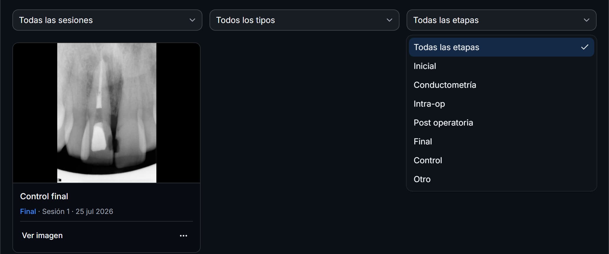 Filtros de la galería de imágenes con la lista de etapas abierta.