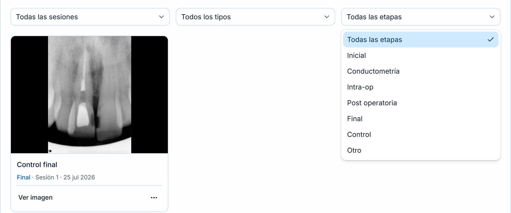 Filtros de la galería de imágenes con la lista de etapas abierta.